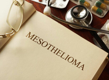 Everything you should know about Mesothelioma